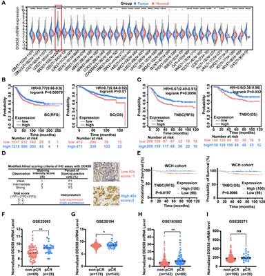 DDX58 deficiency leads to triple negative breast cancer chemotherapy resistance by inhibiting Type I IFN-mediated signalling apoptosis